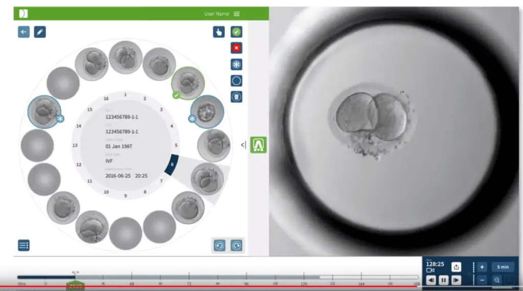 Umělá inteligence v IVF 1 - Devel Sanatorium Helios CZ inkubátor Geri pro IVF